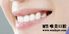 牙齿矫正
