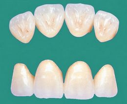 郑州做全瓷牙需要多少钱 郑州做全瓷牙需要多少钱