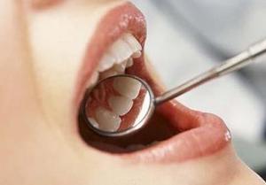 怎样让牙齿洁白