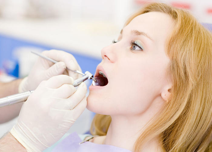 洗牙好不好啊 洗牙好不好啊