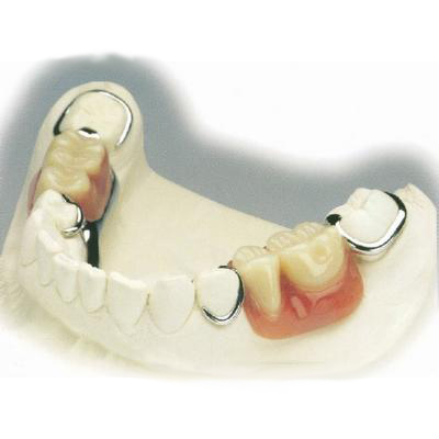 补牙应该注意什么 补牙应该注意什么